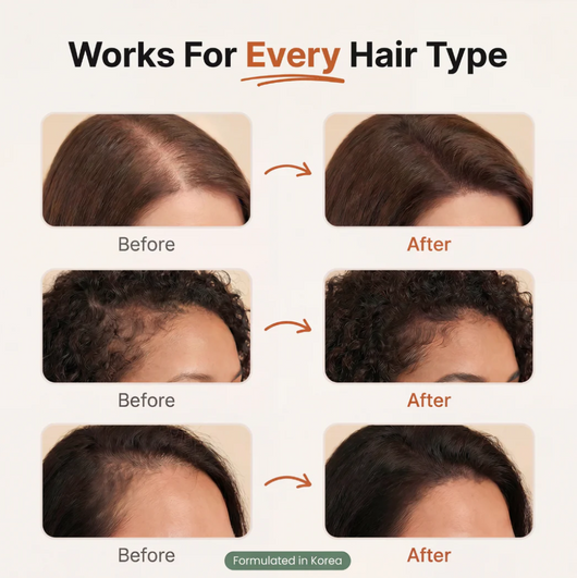 MELVERAL Follicle Renewal Serum™