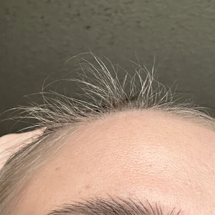 Month 2-3